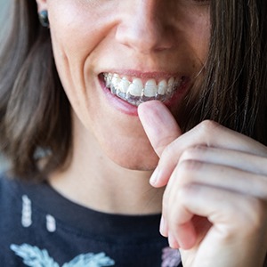 A man holding an Invisalign tray