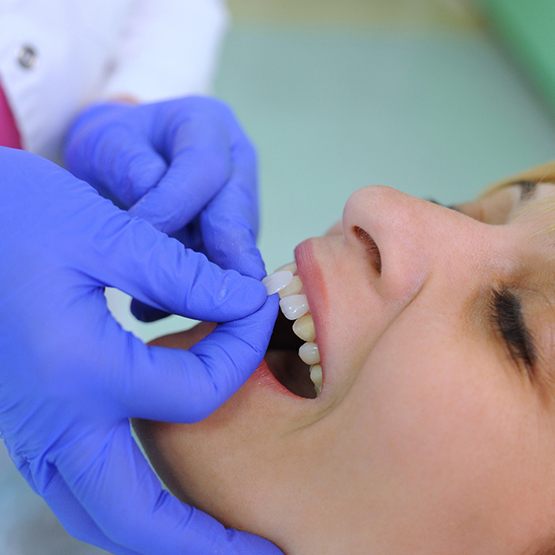 Woman getting veneers